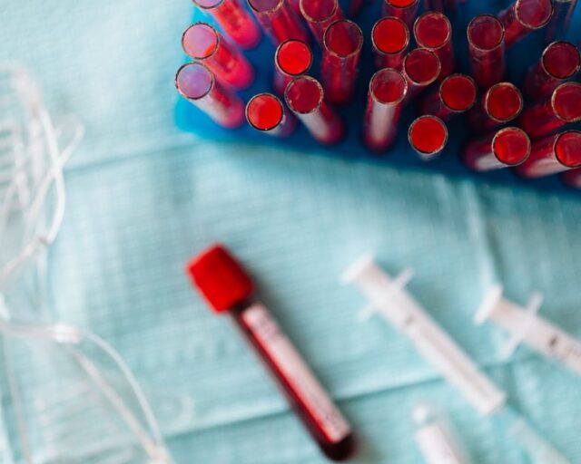 Rinovirus supera al Sincicial en detecciones y positividad de muestras llega a 47%