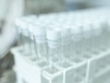 Test rápido para hantavirus desarrollado en UACh avanza en fase de validación