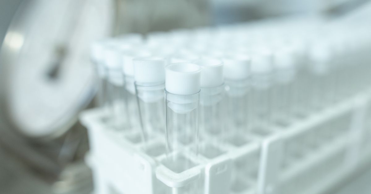 Test rápido para hantavirus desarrollado en UACh avanza en fase de validación